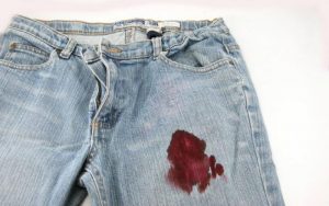 Як видалити пляму від крові: вичерпний посібник для всіх
