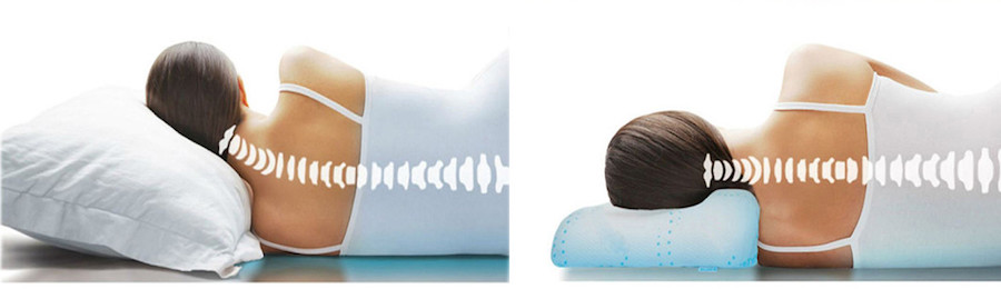 Біль у шиї після сну: чому звичайна подушка не підходить і як ортопедичні моделі вирішують проблему