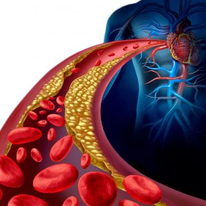 Чистка судин народними методами: ефективні рецепти