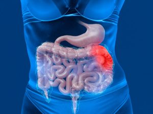 Ендометріоз: що це таке, симптоми та шляхи полегшення