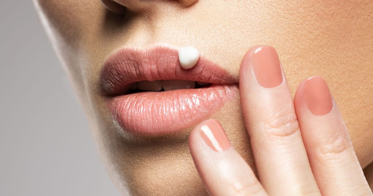 Як позбутися герпесу на губі за одну ніч: швидкі методи полегшення