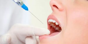 Місцева анестезія: що це таке та як вона перетворює лікування на комфортний досвід