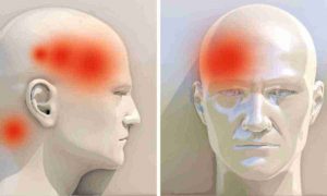 Що робити, коли тошнить і болить голова